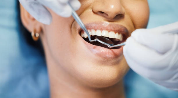 Best Emergency Dental Care for Sports Injuries in Pleasant Hill, MS