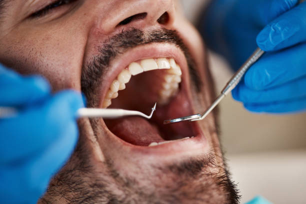 Best Emergency Treatment for Oral Infections in Pleasant Hill, MS