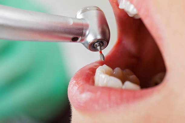 Professional Emergency Dental Service in MS
